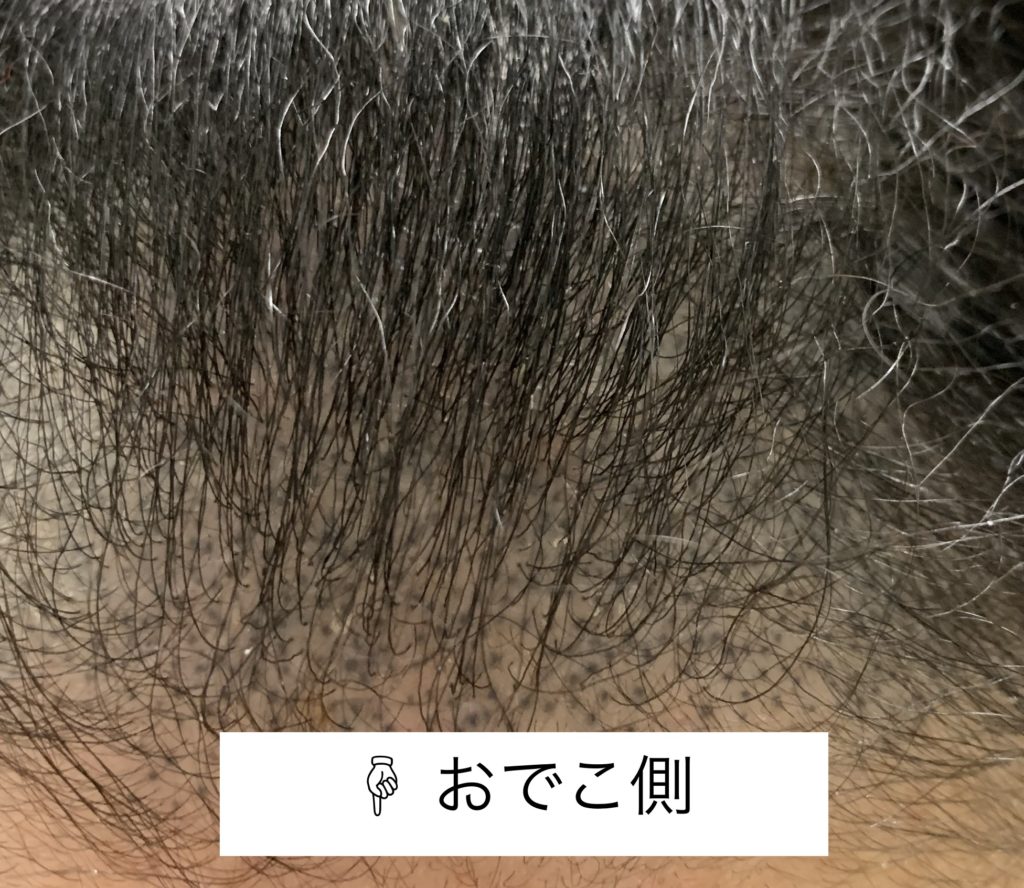 ヘアタトゥーが凄い 実際やってみて感じた５つのことアートメイクとも言うらしい けけけのガール